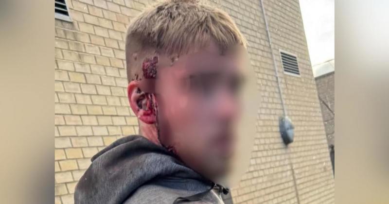 No further action after man injured in suspected axe attack