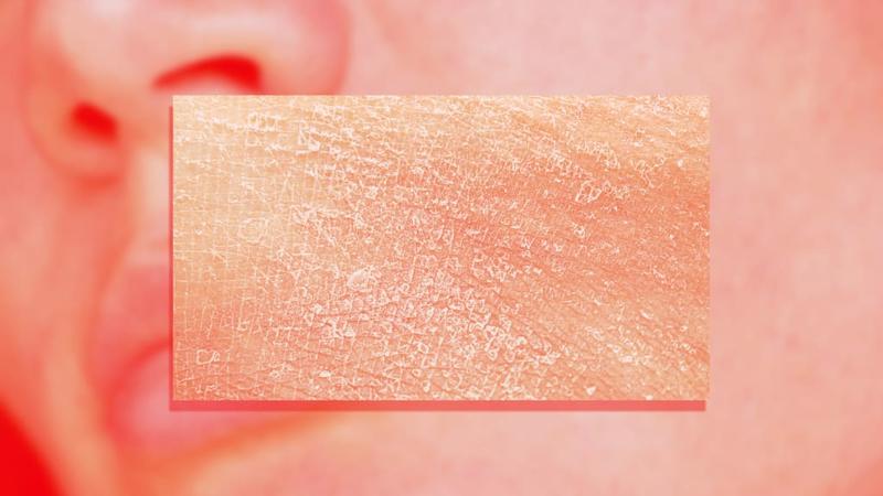 The ‘Caveman Method’ is the latest viral skincare technique. Experts say you should think twice