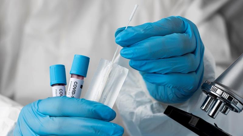 What Goes Around Comes Around: The “Real Cost” of Reckless Gain-of-Function Scientific Research!
