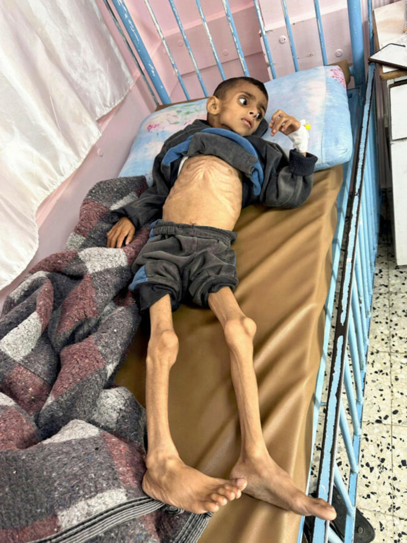 Hunger in Gaza: When starving babies is the strategy, not just the outcome