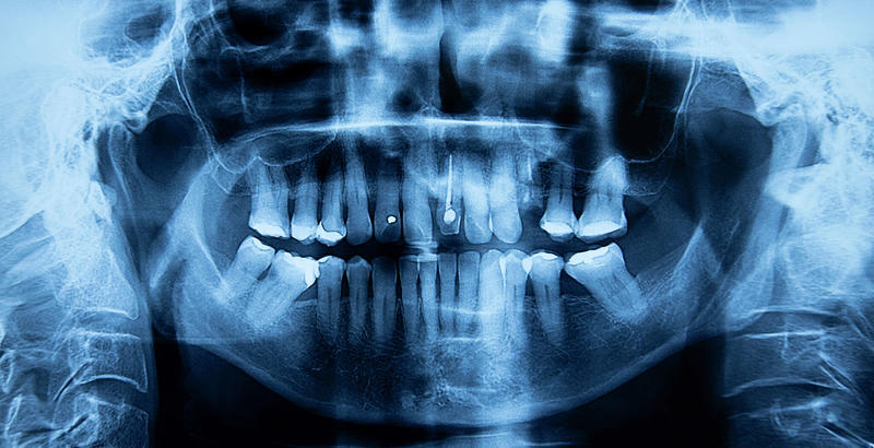 Commentary: Dental care for Medicaid patients is in crisis, but the Legislature can help