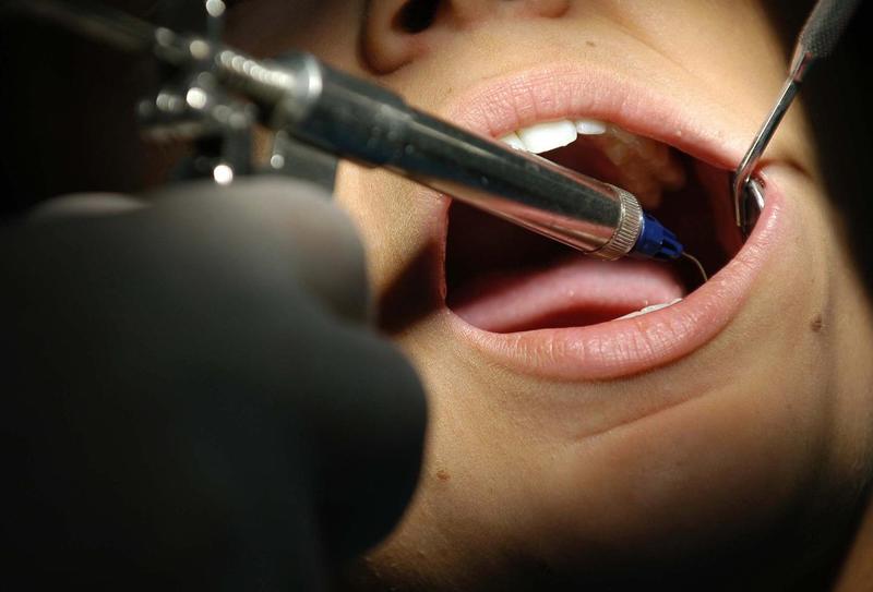 Vigevano, facevano i dentisti ma non avevano la laurea: denunciati