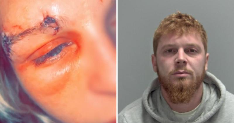 Man who tried to bite out fiancée's eye back in jail after breaching 10-year order