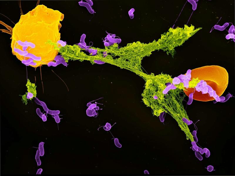 Mitochondria can sense bacteria and trigger your immune system to trap them – revealing new ways to treat infections and autoimmunity 