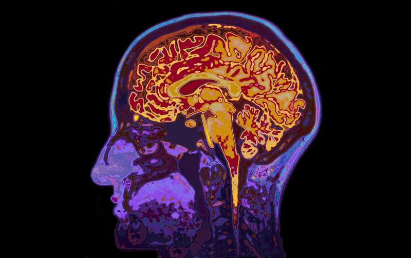 ¿Que pasa en el cerebro cuando “caemos en la tentación”? Neurociencia de la corrupción política