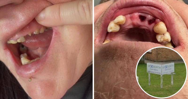 'Everyone stares' - Man left missing teeth after dentist takeover
