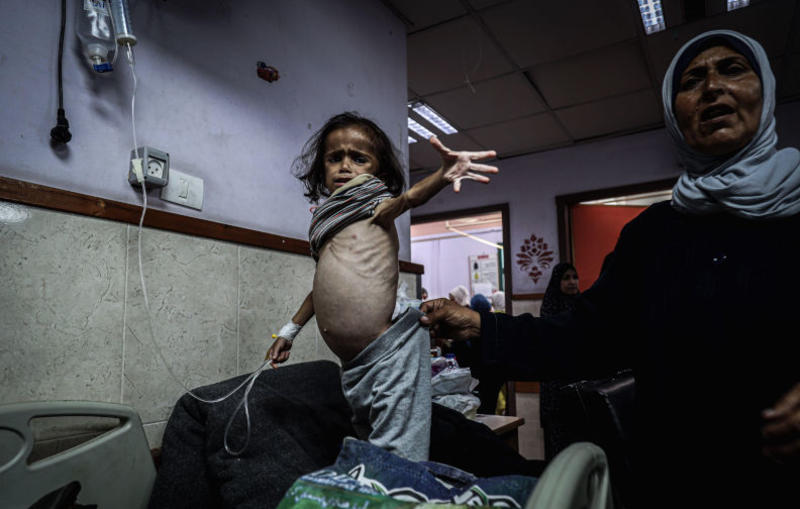 More than 5,800 Gaza children diagnosed with malnutrition in June: UNICEF