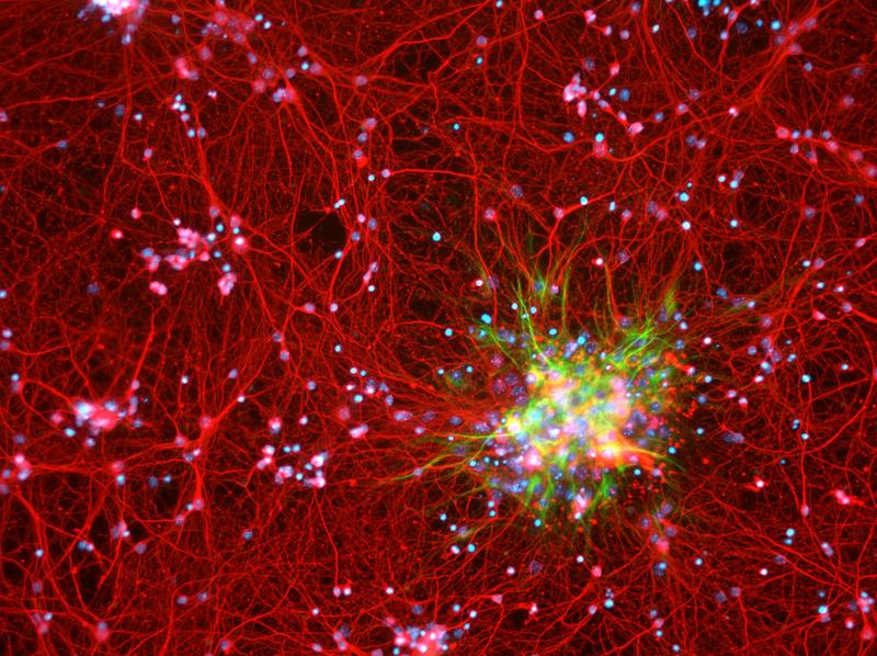 Ces cellules du cerveau qui pourraient aider à lutter contre l’obésité