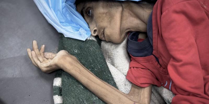 Do the Starving in Gaza Feel Betrayed by Humanity?