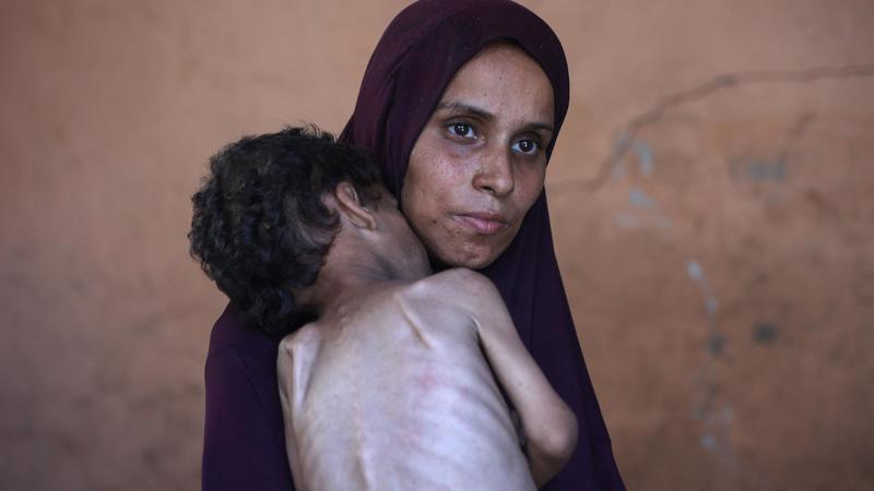 Se muore l’umanità, la fame fa strage di bimbi a Gaza: denutrito uno su tre /