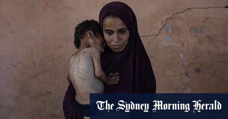 Starvation in Gaza is despicable and must be a turning point in this hideous war