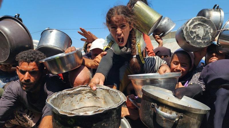 Mass starvation in Gaza is the great horror of our age