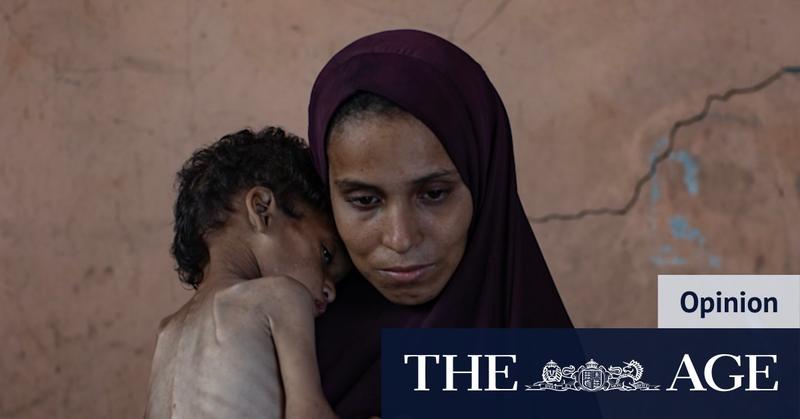 I saw starving children every day in Gaza. It makes you question humanity