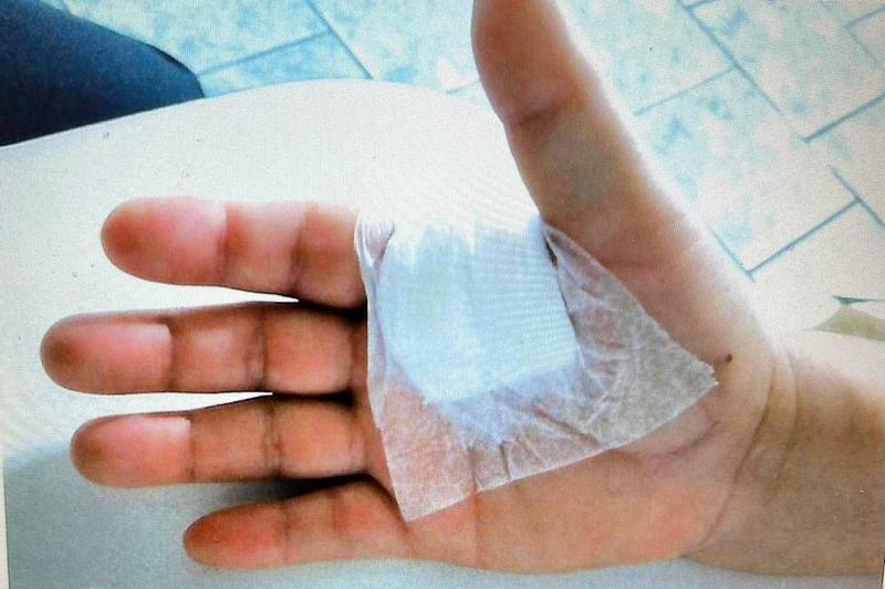 Médico é condenado em São Paulo por operar dedo errado de paciente