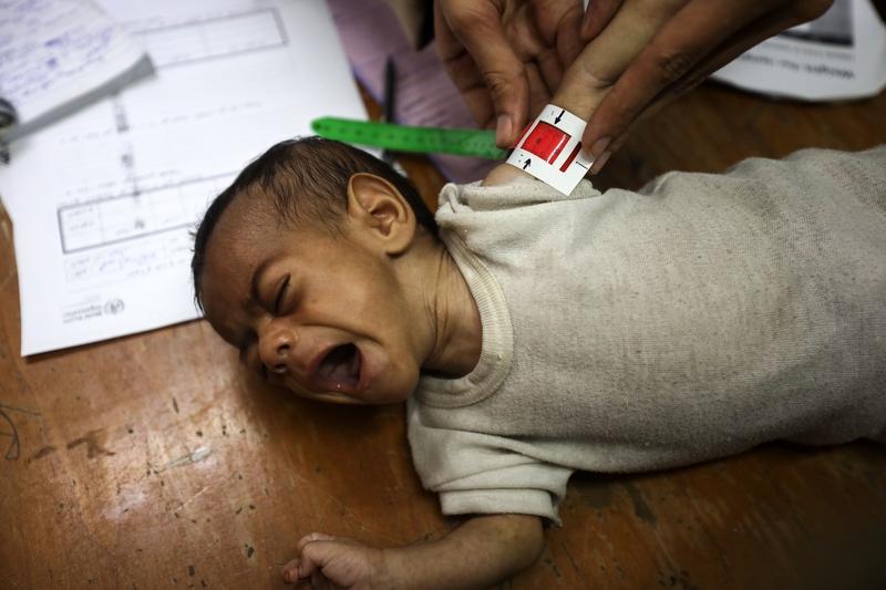 Israel Has Starved at Least 83 Children to Death in Gaza, Health Officials Say