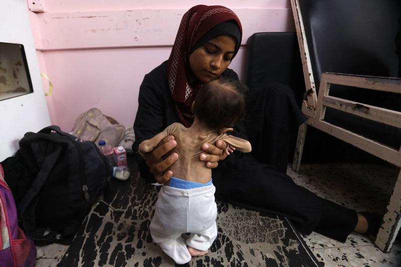 As a Medical Student in Gaza, I Studied Malnutrition. Now It’s All Around Me.
