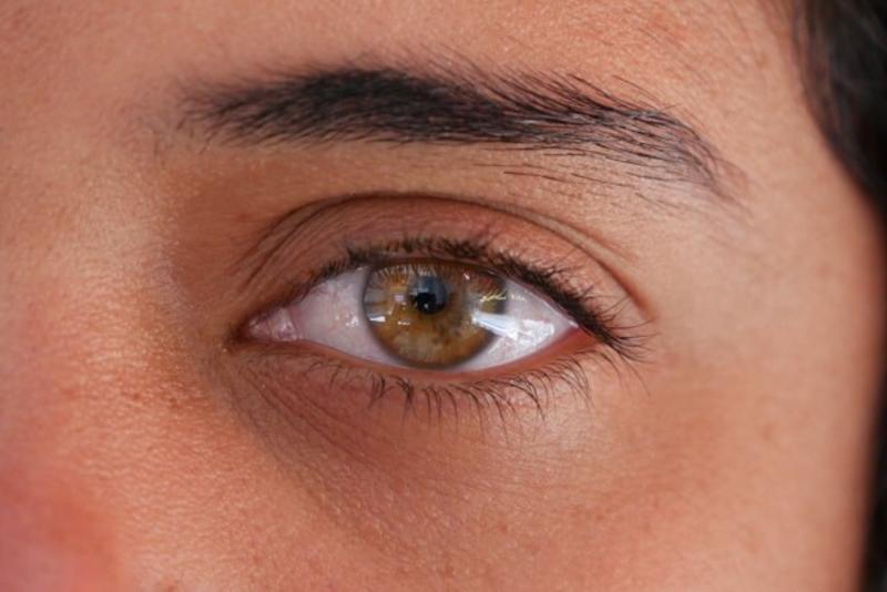 Understanding cataracts