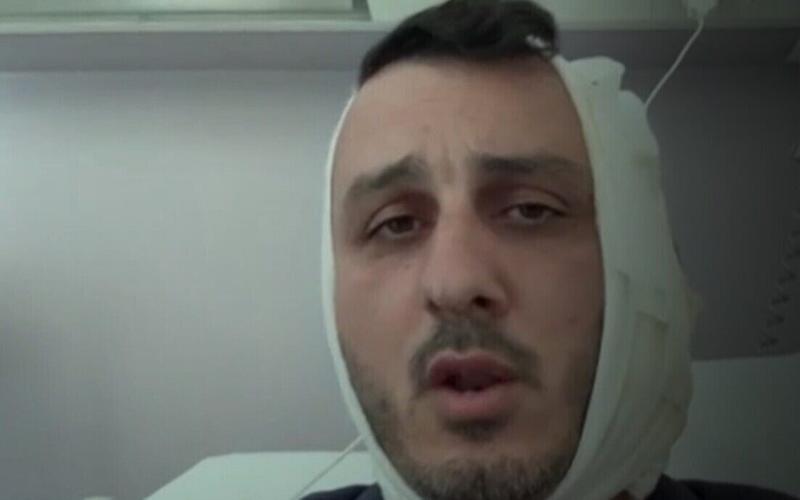 Israeli says man screamed ‘F*ck Israel, I’m Hamas,’ bit part of his ear off in Greece