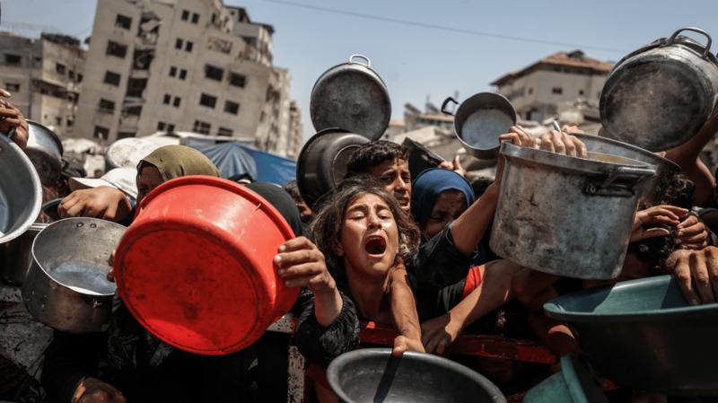 “This Is Trump’s Famine”: How the US Is Complicit in Gaza’s Suffering