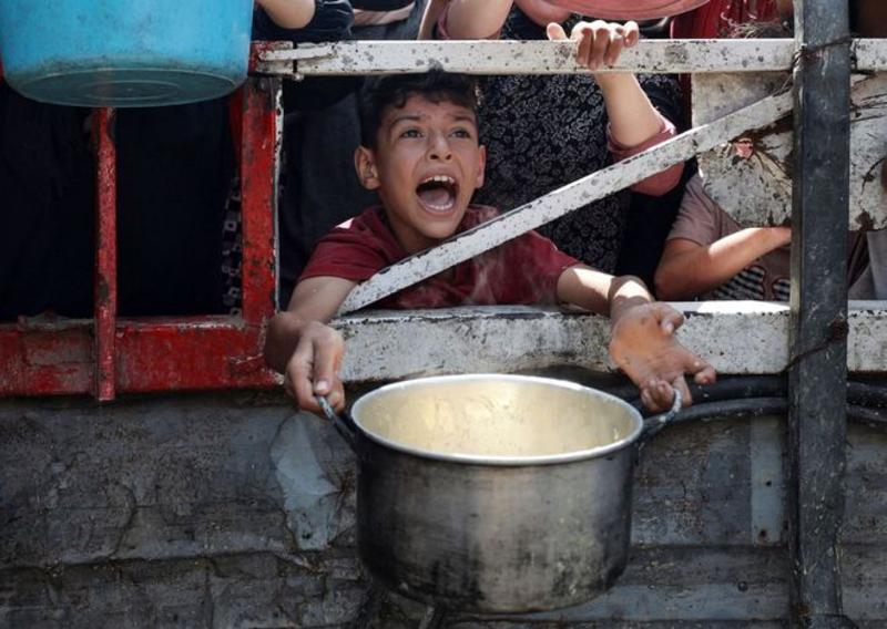 VOX POPULI: Children’s lives hang by a thread in Gaza’s man-made famine