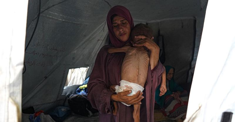 New York Times Issues Editor’s Note Over Condition of Child in Viral Image