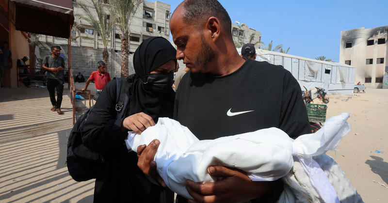 On Gaza malnutrition ward, a child’s arm is as wide as mother’s thumb