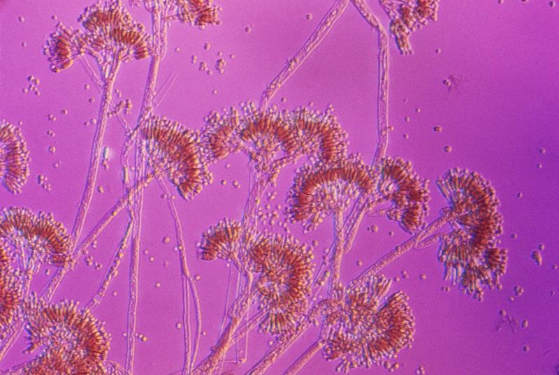 Are you really allergic to penicillin? A pharmacist explains why there’s a good chance you’re not − and how you can find out for sure
