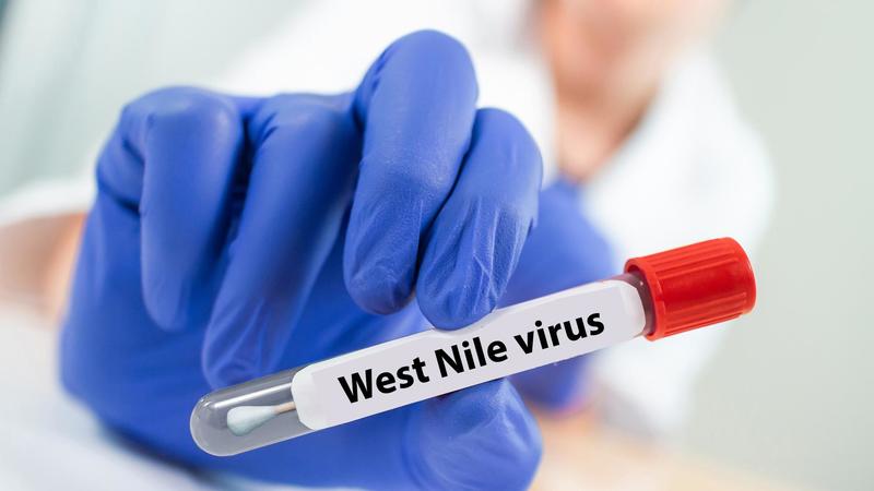 West Nile, le donazioni di sangue sono sicure? Pregliasco: “Vi spiego cosa succede oggi in Italia” /