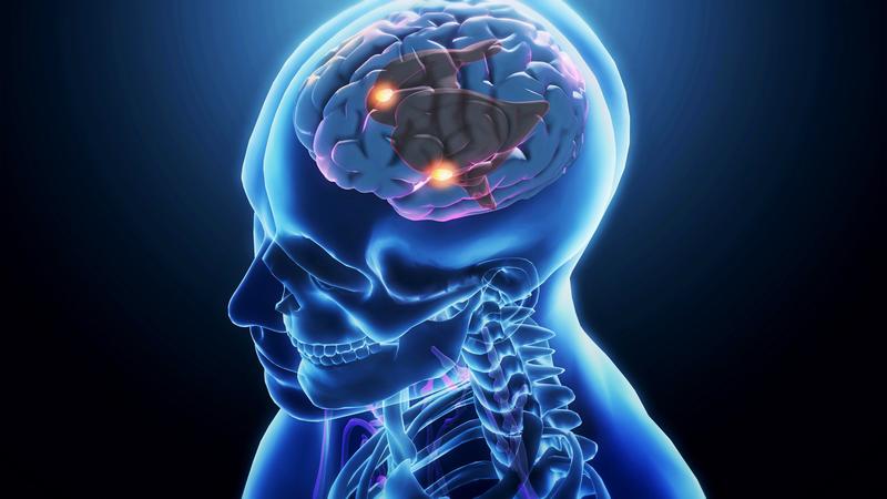 Alzheimer: una nuova medicina rallenta la malattia