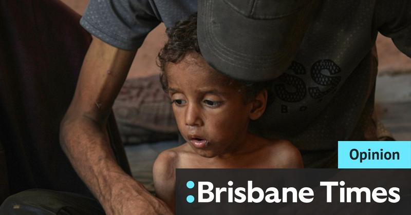 Israel must open its eyes: Defeating Hamas does not require starving a single child