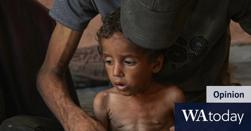 Israel must open its eyes: Defeating Hamas does not require starving a single child
