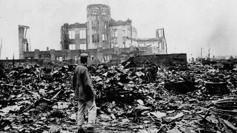 Hiroshima | Hiroshima 1945: Die US-Regierung zensierte die Bilder der Toten und Schwerverletzten