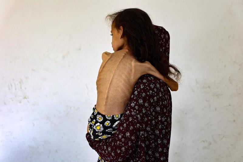 Stopp sultkrisen i Gaza nå