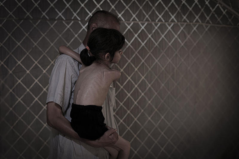 Editorial: Gaza, starving for peace