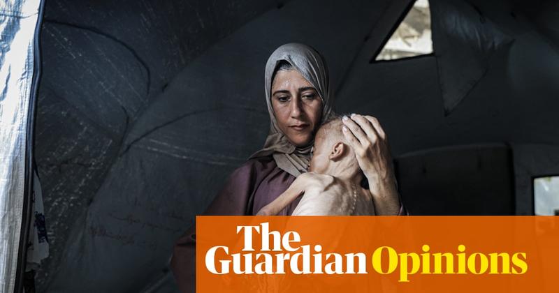 We published a photo of a malnourished child in Gaza. It made an impact globally – and created controversy