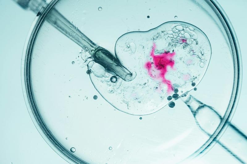 Weight loss support before IVF could boost pregnancy chances – and reduce the need for treatment