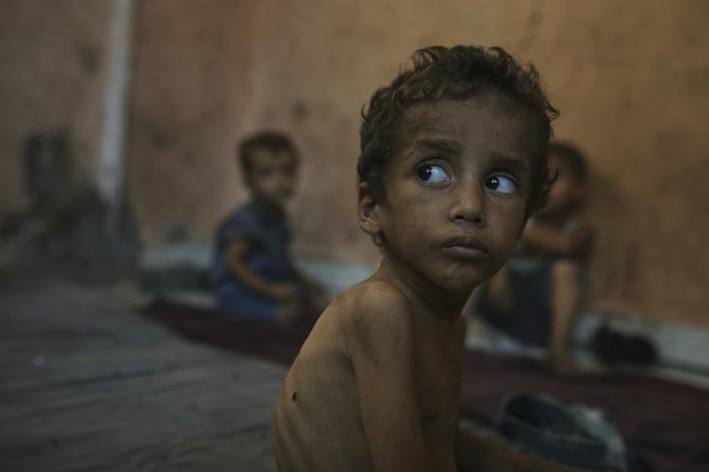 The dark history of forced starvation as a weapon of war against Indigenous peoples