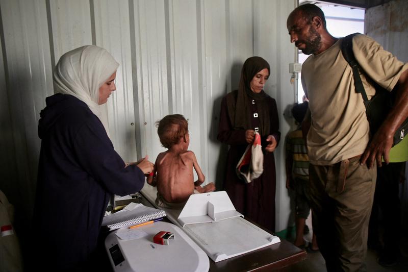 UN says 13,000 children treated for malnutrition in Gaza in July as aid trickles in