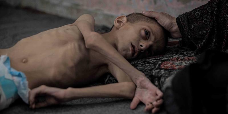 Starvation in Gaza and Our Global Shame