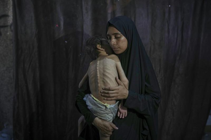 Images from Gaza have shocked the world – but the ‘spectacle of suffering’ is a double-edged  sword