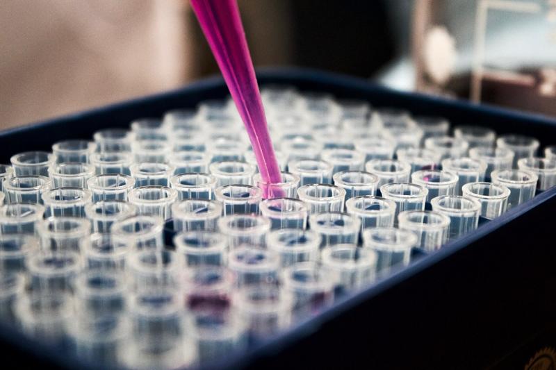 Legionella, campagna di prevenzione Asl Bari per circa 1.400 strutture tra Rsa, alberghi e B&B