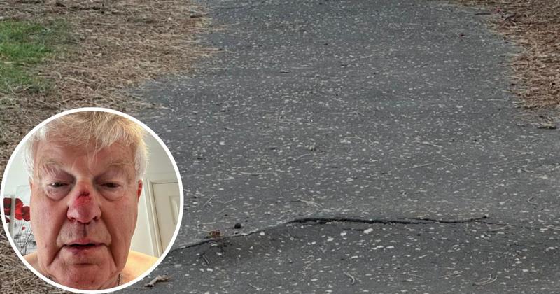 Man suffers bad cut to face after fall at 'dangerous' footpath