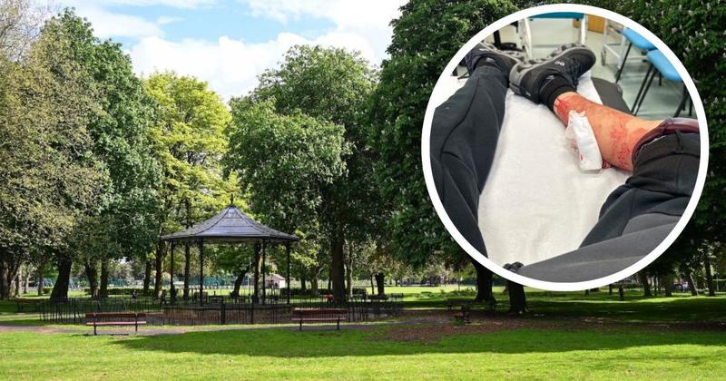 Mum ‘terrified’ after son, 16, stabbed in horror knife attack at park