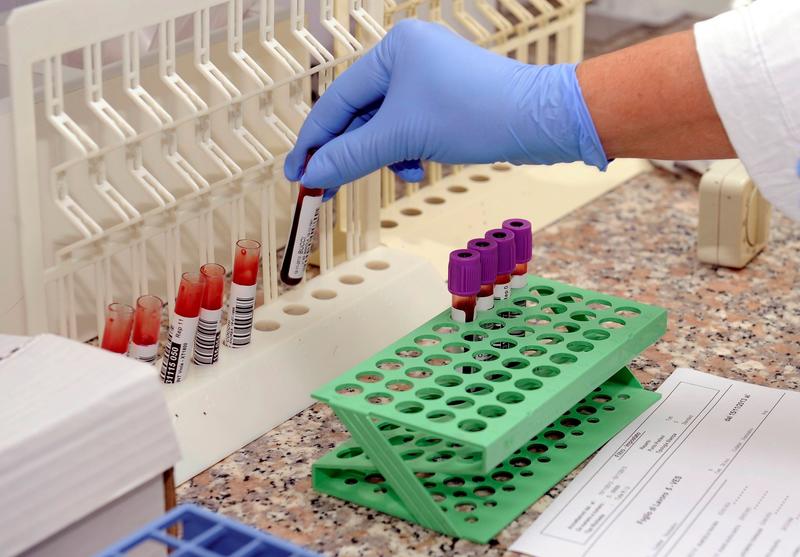 Glioblastoma, c’è una nuova arma contro uno dei tumori cerebrali più aggressivi: lo studio dell’Istituto Besta di Milano