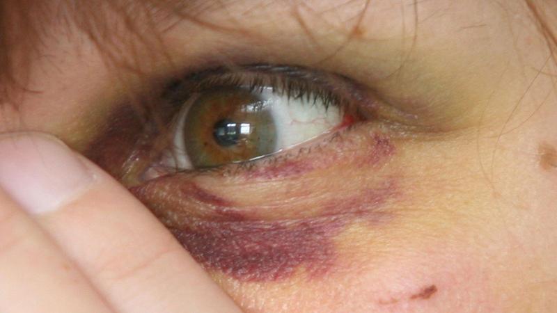 Frauen vor Gewalt besser schützen: So gelingt es in Thüringen bislang