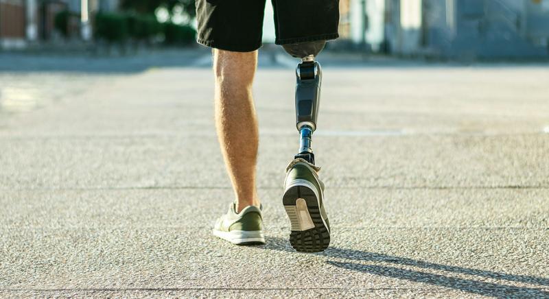Scientists have been wrong about phantom limbs for decades – new study