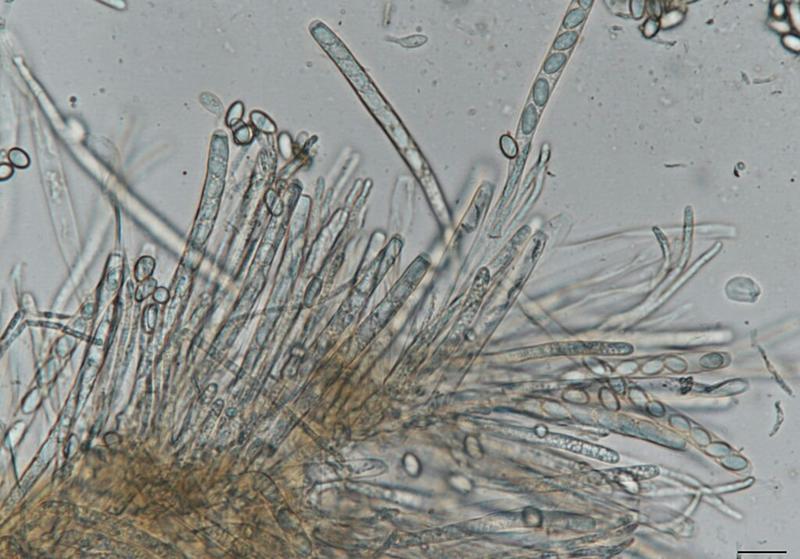 White mold fungi split their genome across several nuclei, with implications for future gene editing