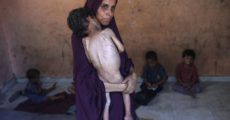 NGO says starving Gaza children too weak to cry