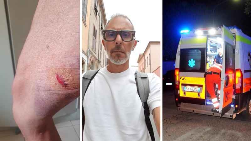 Picchiati sotto casa in pieno centro. “Urinava sul nostro cancello, l’ho sgridato e ci ha aggrediti”
