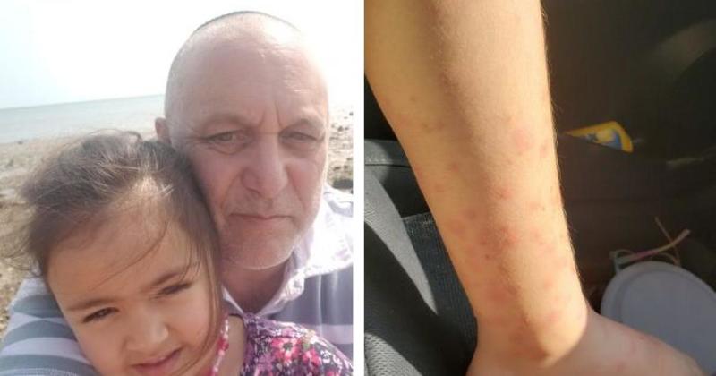 Family's Norfolk holiday ruined after bed bugs 'infest' caravan